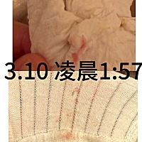 上次姨妈是2.13-2.18 2.23号晚上到24号早上也有同房没有保护这个月姨妈14号来乳房从6号开始痛的跟我平时...