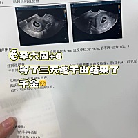 等了三天终于出结果了