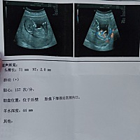 帮忙看男女