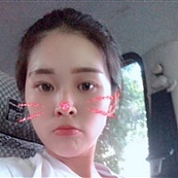 张瑞