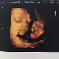 건우맘💄[帖主]