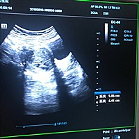 明天和意外那个先来