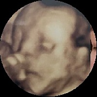 顺心顺意男宝一