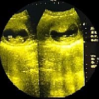 绿叶产品！崔思敏！