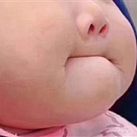 西瓜瓜