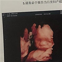 李娜