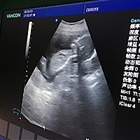 菠萝