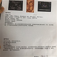 十七