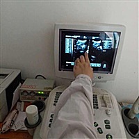 查男女宝宝性别